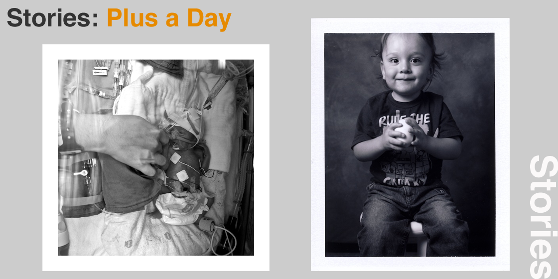 Plus a Day: from 13 weeks early to two years on.